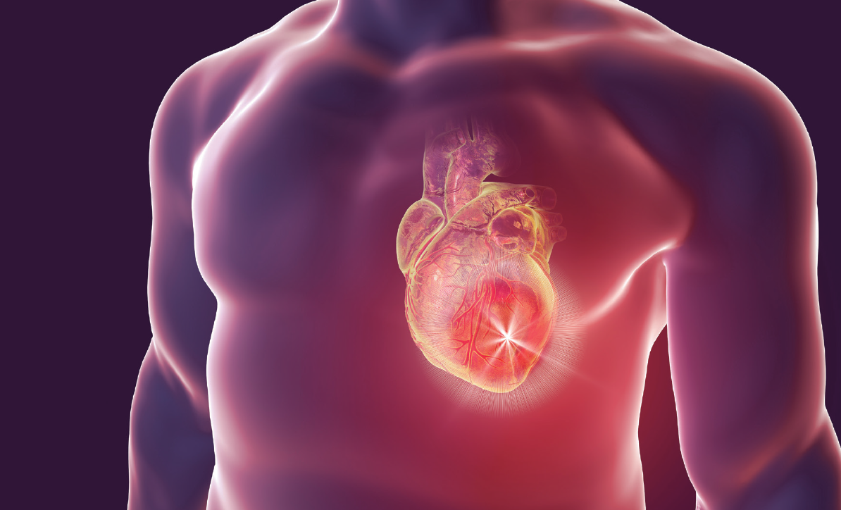 cardiopatia-isquemica