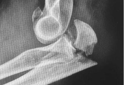 imatge 3a jornada cirurgia ortopèdica i traumatologia