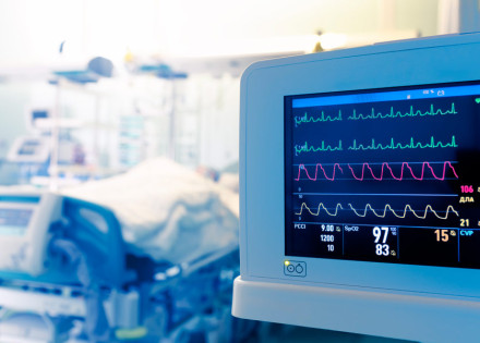 Pantalla de monitoratge en una UCI