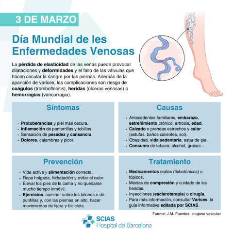 Infografía sobre el Día Mundial de las Enfermedades Venosas