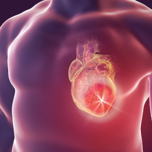 cardiopatia-isquemica